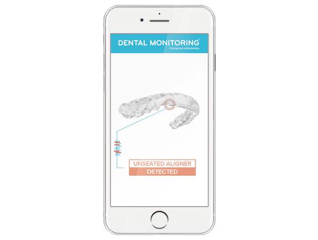 What is Dental Monitoring?